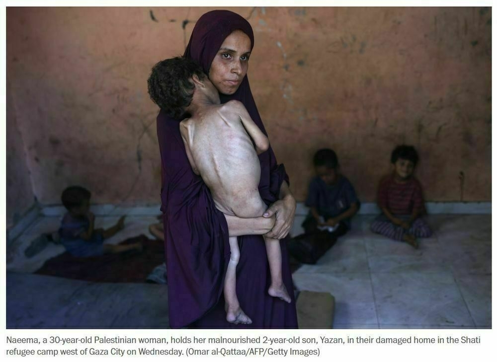 photo of malnourished child in Palestine, from Washington Post